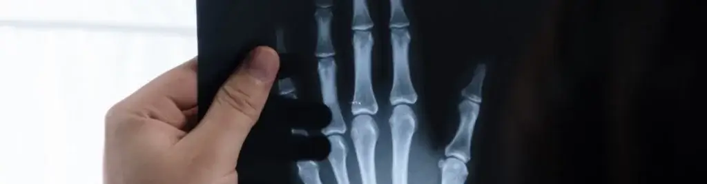 Dangers of  X-Rays and Electronic Imaging Procedures