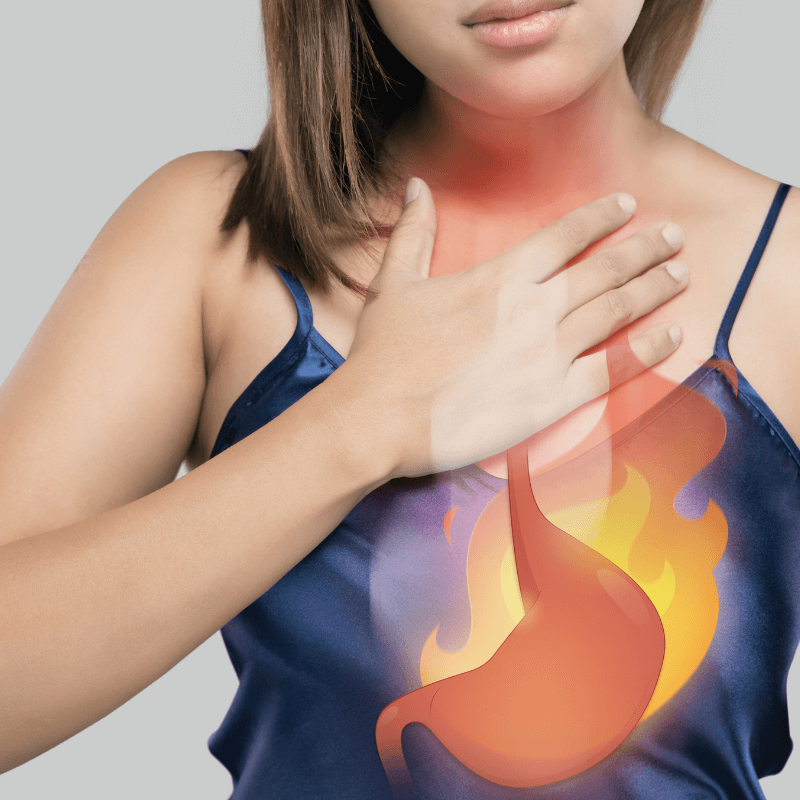 Heartburn-Free Thanksgiving | Tips for Avoiding GERD