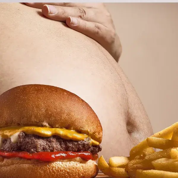 Obesity and COVID-19: 5 Reasons it’s a Risky Combo